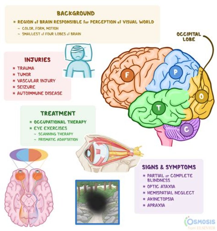 Comprehensive Guide to Upper Molar Root: Understanding Its Structure, Function, and Health