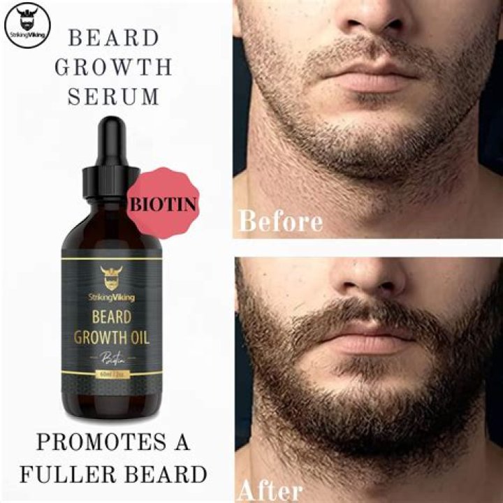 Does Beard Oil Help Beard Grow: A Comprehensive Guide
