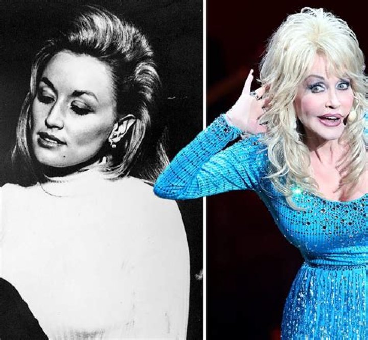 Dolly Parton Without Wig: The Iconic Country Star's Natural Look