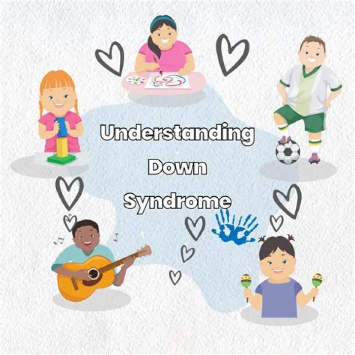 George Clooney's Twins: Understanding Down Syndrome and Parenting Challenges