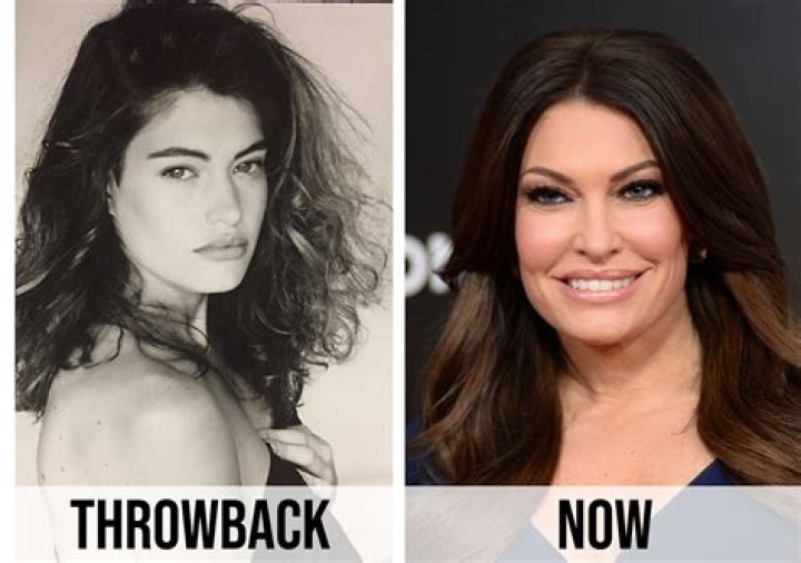 Kimberly Guilfoyle Plastic Surgery Photos: A Comprehensive Insight into Her Transformation