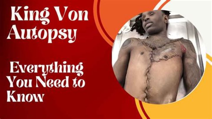 King Von's Autopsy: A Deep Dive into the Life, Death, and Legacy of a Rising Star