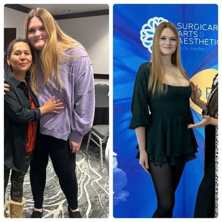 Ozempic Celebrity Before and After: The Ultimate Guide to Weight Loss Transformation